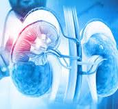 Nephrology