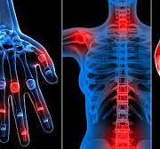 Rheumatology